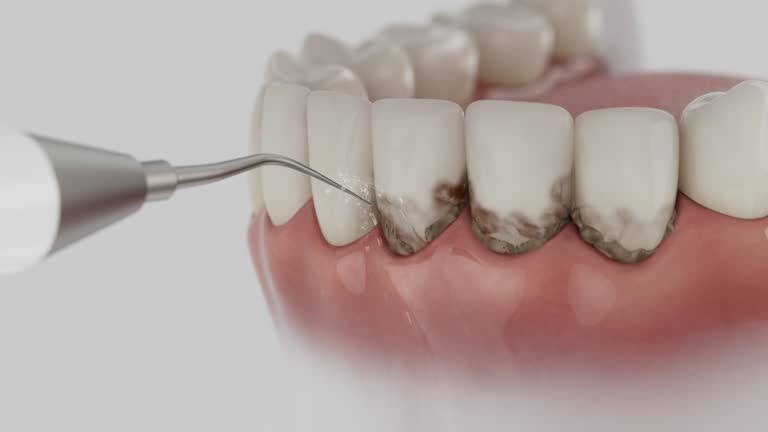 Trusted Teeth Cleaning And Checkup service in West Jefferson, NC - Dentist Open Now